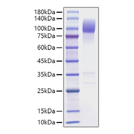 SDS-PAGE - Recombinant Mouse SIRP alpha Protein (C-terminal Human Fc Tag) (A331862) - Antibodies.com