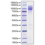 SDS-PAGE - Recombinant Mouse SIRP alpha Protein (C-terminal Human Fc Tag) (A331862) - Antibodies.com