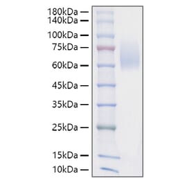 SDS-PAGE - Recombinant Mouse SIRP alpha Protein (C-terminal His Tag) (A331863) - Antibodies.com