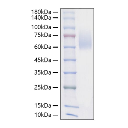 SDS-PAGE - Recombinant Mouse SIRP alpha Protein (C-terminal His Tag) (A331863) - Antibodies.com