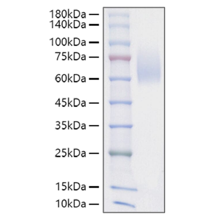SDS-PAGE - Recombinant Mouse SIRP alpha Protein (C-terminal His Tag) (A331863) - Antibodies.com