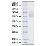 SDS-PAGE - Recombinant Mouse SIRP alpha Protein (C-terminal His Tag) (A331863) - Antibodies.com