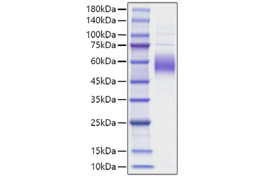 SDS-PAGE - Recombinant Mouse SIRPB1A Protein (C-terminal His Tag) (A331864) - Antibodies.com
