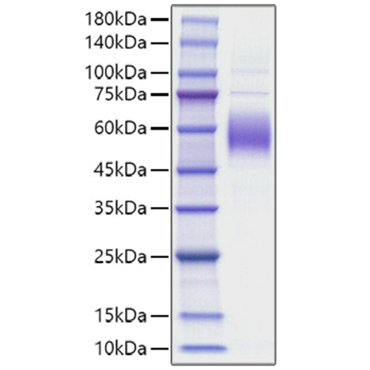 SDS-PAGE - Recombinant Mouse SIRPB1A Protein (C-terminal His Tag) (A331864) - Antibodies.com