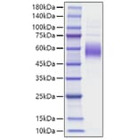 SDS-PAGE - Recombinant Mouse SIRPB1A Protein (C-terminal His Tag) (A331864) - Antibodies.com