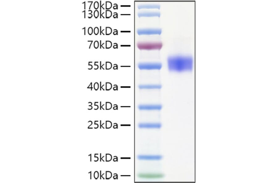 SDS-PAGE - Recombinant Human SIRP beta 1 Protein (C-terminal His Tag) (A331865) - Antibodies.com