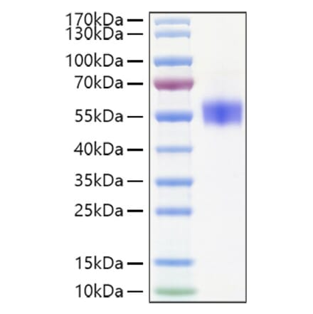 SDS-PAGE - Recombinant Human SIRP beta 1 Protein (C-terminal His Tag) (A331865) - Antibodies.com