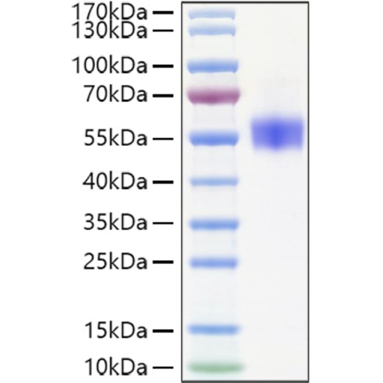 SDS-PAGE - Recombinant Human SIRP beta 1 Protein (C-terminal His Tag) (A331865) - Antibodies.com