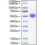 SDS-PAGE - Recombinant Human SIRP beta 1 Protein (C-terminal His Tag) (A331865) - Antibodies.com