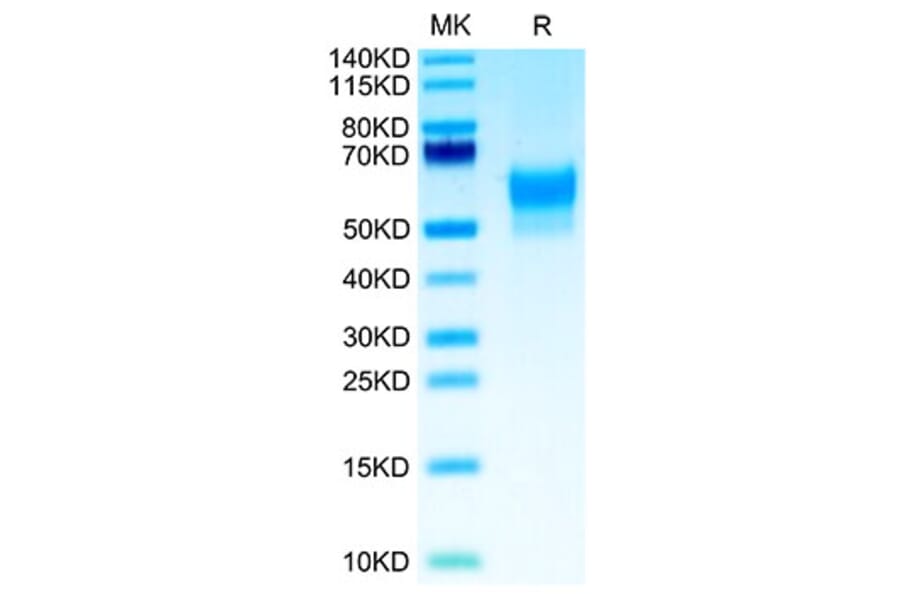 Tris-Bis PAGE - Recombinant Human SIRP beta 1 Protein (Biotin) (C-terminal His and Avi Tag) (A331866) - Antibodies.com