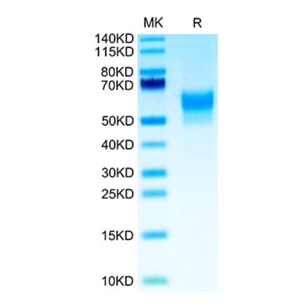 Tris-Bis PAGE - Recombinant Human SIRP beta 1 Protein (Biotin) (C-terminal His and Avi Tag) (A331866) - Antibodies.com
