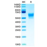 Tris-Bis PAGE - Recombinant Human SIRP beta 1 Protein (Biotin) (C-terminal His and Avi Tag) (A331866) - Antibodies.com