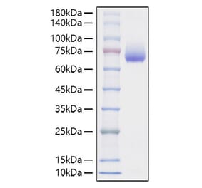 SDS-PAGE - Recombinant Mouse CD48 Protein (C-terminal Human Fc Tag) (A331867) - Antibodies.com