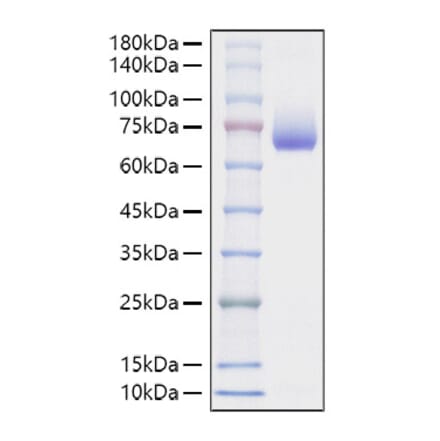 SDS-PAGE - Recombinant Mouse CD48 Protein (C-terminal Human Fc Tag) (A331867) - Antibodies.com