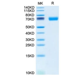 Tris-Bis PAGE - Recombinant Mouse SLAMF6 Protein (C-terminal Human Fc Tag) (A331869) - Antibodies.com