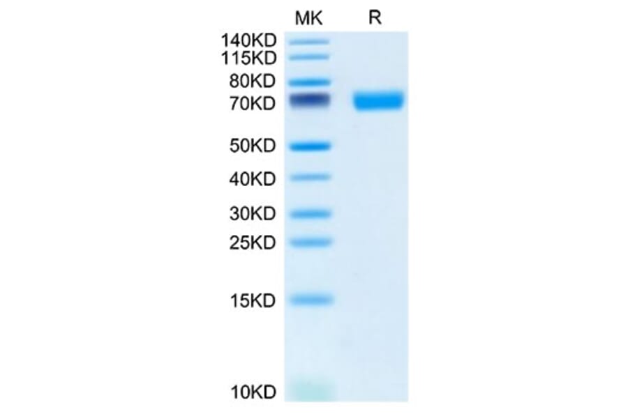Tris-Bis PAGE - Recombinant Mouse SLAMF6 Protein (C-terminal Human Fc Tag) (A331869) - Antibodies.com