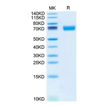 Tris-Bis PAGE - Recombinant Mouse SLAMF6 Protein (C-terminal Human Fc Tag) (A331869) - Antibodies.com