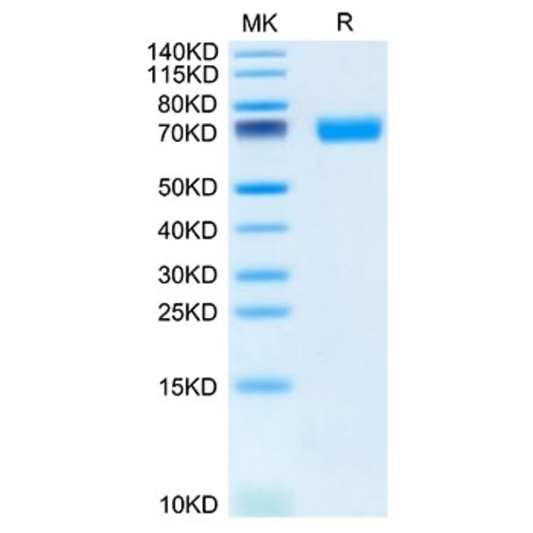 Tris-Bis PAGE - Recombinant Mouse SLAMF6 Protein (C-terminal Human Fc Tag) (A331869) - Antibodies.com