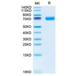 Tris-Bis PAGE - Recombinant Mouse SLAMF6 Protein (C-terminal Human Fc Tag) (A331869) - Antibodies.com