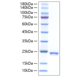 SDS-PAGE - Recombinant Rat SHH Protein (C-terminal His Tag) (A331870) - Antibodies.com