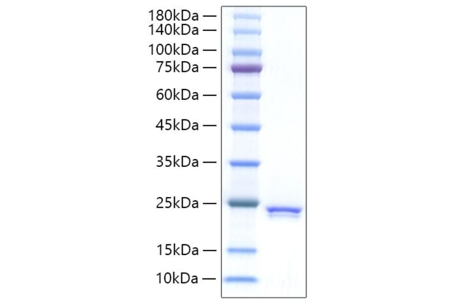 SDS-PAGE - Recombinant Rat SHH Protein (C-terminal His Tag) (A331870) - Antibodies.com