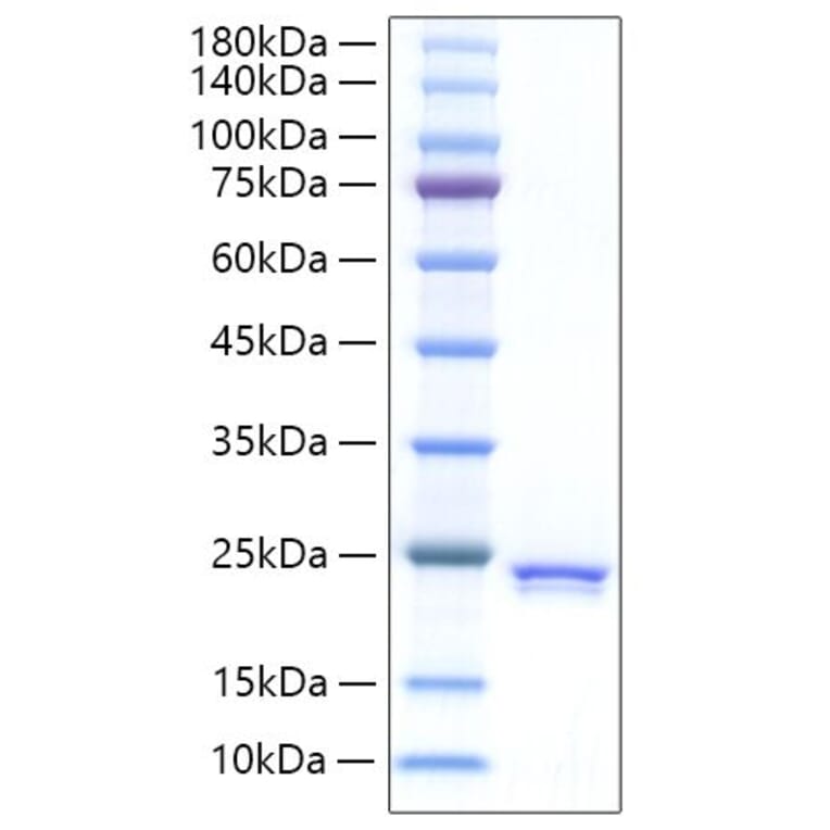SDS-PAGE - Recombinant Rat SHH Protein (C-terminal His Tag) (A331870) - Antibodies.com
