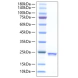 SDS-PAGE - Recombinant Rat SHH Protein (C-terminal His Tag) (A331870) - Antibodies.com