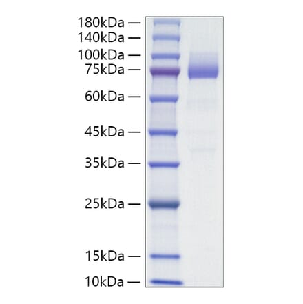 SDS-PAGE - Recombinant Mouse CD36 Protein (C-terminal His Tag) (A331871) - Antibodies.com