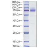 SDS-PAGE - Recombinant Mouse CD36 Protein (C-terminal His Tag) (A331871) - Antibodies.com