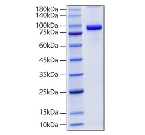 SDS-PAGE - Recombinant Mouse CD71 Protein (C-terminal His Tag) (A331872) - Antibodies.com