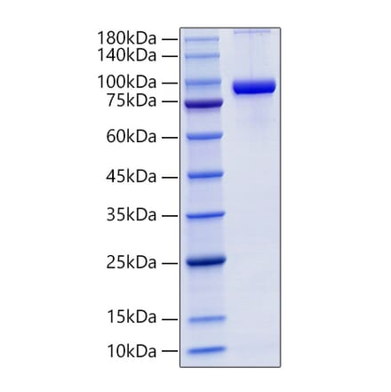 SDS-PAGE - Recombinant Mouse CD71 Protein (C-terminal His Tag) (A331872) - Antibodies.com