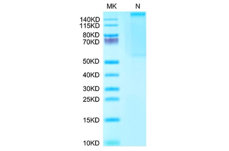Tris-Bis PAGE - Recombinant Human AFP + HLA-A*02:01 Protein (C-terminal His and Avi Tag) (A331873) - Antibodies.com