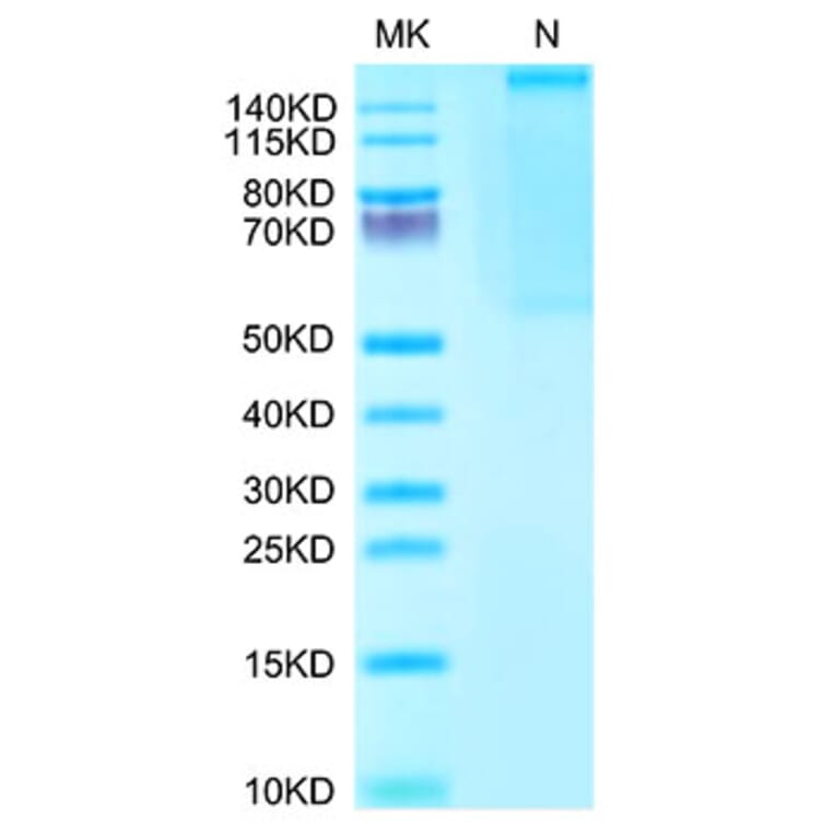 Tris-Bis PAGE - Recombinant Human AFP + HLA-A*02:01 Protein (C-terminal His and Avi Tag) (A331873) - Antibodies.com