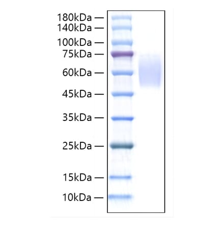 SDS-PAGE - Recombinant Rat Thrombopoietin Protein (C-terminal His Tag) (A331876) - Antibodies.com