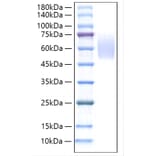 SDS-PAGE - Recombinant Rat Thrombopoietin Protein (C-terminal His Tag) (A331876) - Antibodies.com