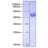 SDS-PAGE - Recombinant Mouse TSLP Protein (C-terminal Human Fc Tag) (A331878) - Antibodies.com