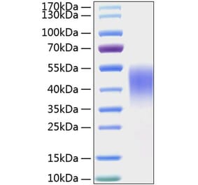 SDS-PAGE - Recombinant Mouse TIM 3 Protein (C-terminal His Tag) (A331879) - Antibodies.com