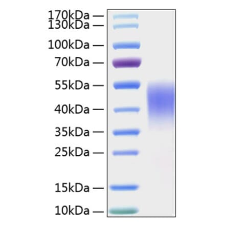 SDS-PAGE - Recombinant Mouse TIM 3 Protein (C-terminal His Tag) (A331879) - Antibodies.com