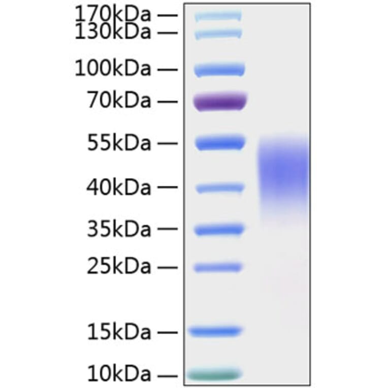 SDS-PAGE - Recombinant Mouse TIM 3 Protein (C-terminal His Tag) (A331879) - Antibodies.com