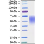SDS-PAGE - Recombinant Mouse TIM 3 Protein (C-terminal His Tag) (A331879) - Antibodies.com