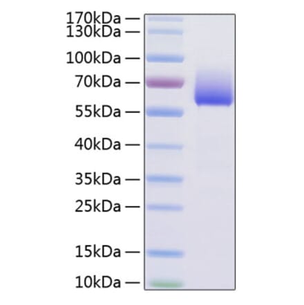 SDS-PAGE - Recombinant Mouse TIM 3 Protein (C-terminal Human Fc and His Tag) (A331880) - Antibodies.com