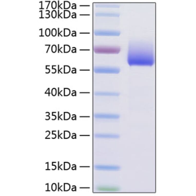 SDS-PAGE - Recombinant Mouse TIM 3 Protein (C-terminal Human Fc and His Tag) (A331880) - Antibodies.com
