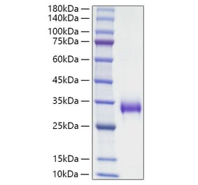 SDS-PAGE - Recombinant Mouse TIMP1 Protein (C-terminal His Tag) (A331881) - Antibodies.com