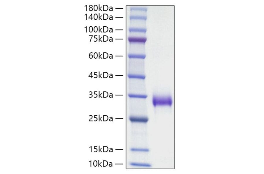 SDS-PAGE - Recombinant Mouse TIMP1 Protein (C-terminal His Tag) (A331881) - Antibodies.com