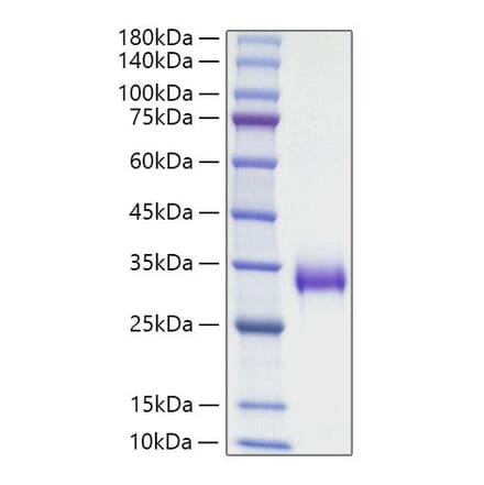 SDS-PAGE - Recombinant Mouse TIMP1 Protein (C-terminal His Tag) (A331881) - Antibodies.com