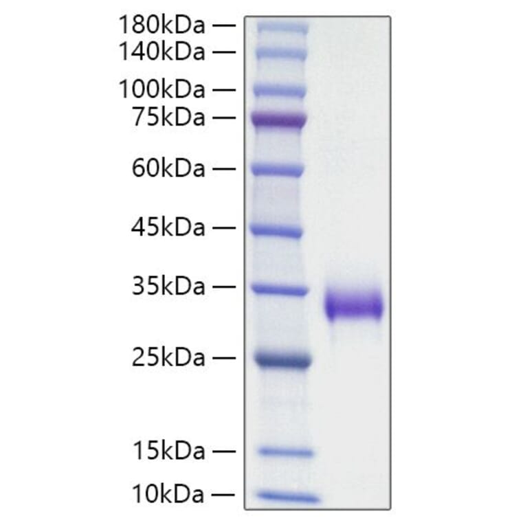 SDS-PAGE - Recombinant Mouse TIMP1 Protein (C-terminal His Tag) (A331881) - Antibodies.com