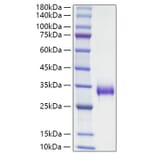 SDS-PAGE - Recombinant Mouse TIMP1 Protein (C-terminal His Tag) (A331881) - Antibodies.com