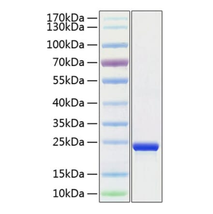 SDS-PAGE - Recombinant Human TMPO Protein (C-terminal His Tag) (A331882) - Antibodies.com