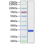 SDS-PAGE - Recombinant Human TMPO Protein (C-terminal His Tag) (A331882) - Antibodies.com