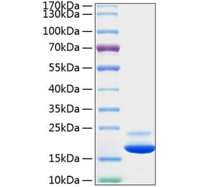 SDS-PAGE - Recombinant Mouse TNF-alpha Protein (C-terminal His Tag) (A331883) - Antibodies.com